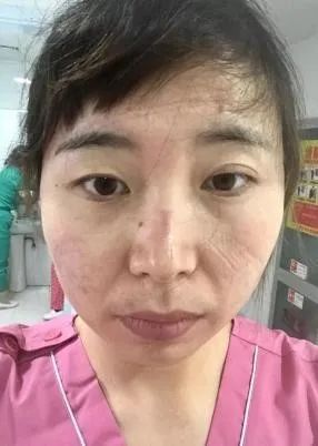 沈杭 安徽醫(yī)科大學(xué)第四附屬醫(yī)院EICU護士長 沈杭 安徽醫(yī)科大學(xué)第四附屬醫(yī)院EICU護士長